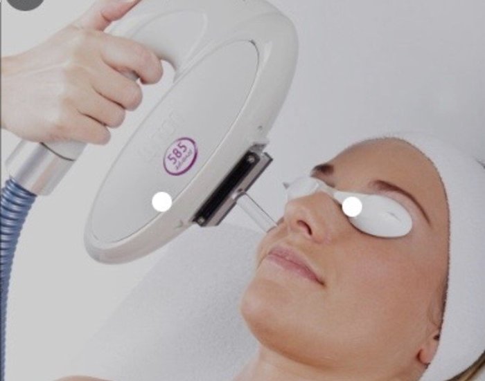 Illumi laser hair removal reviews